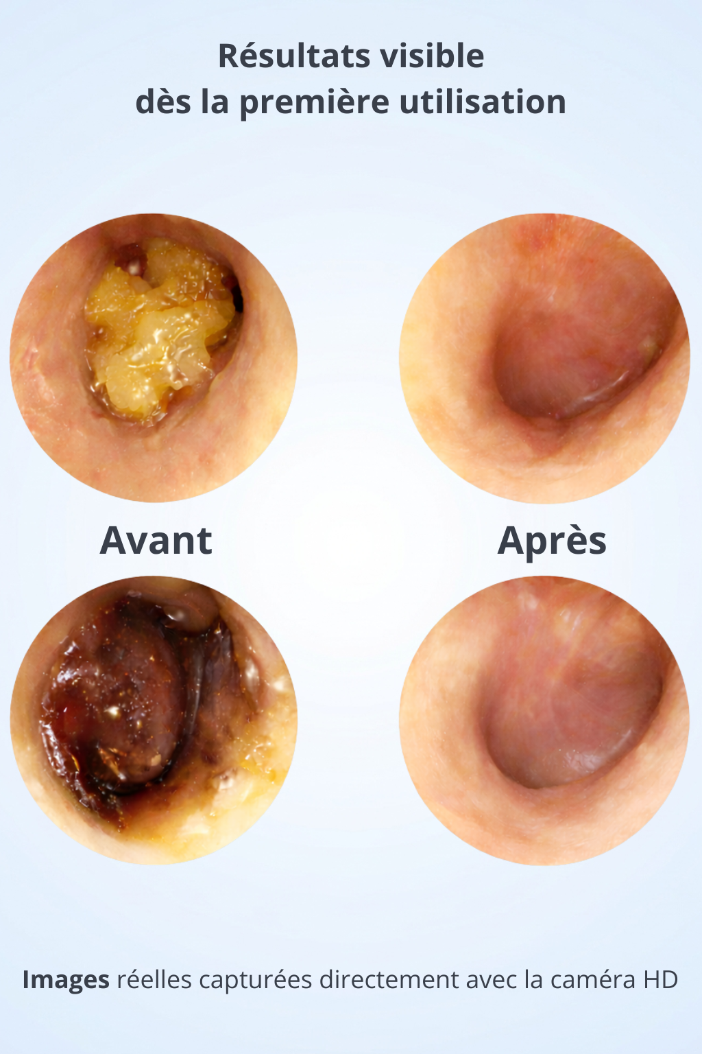 Ear Pro™ - Maîtrisez votre hygiène auditive avec une précision médicale